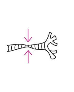 Dog Trachea
